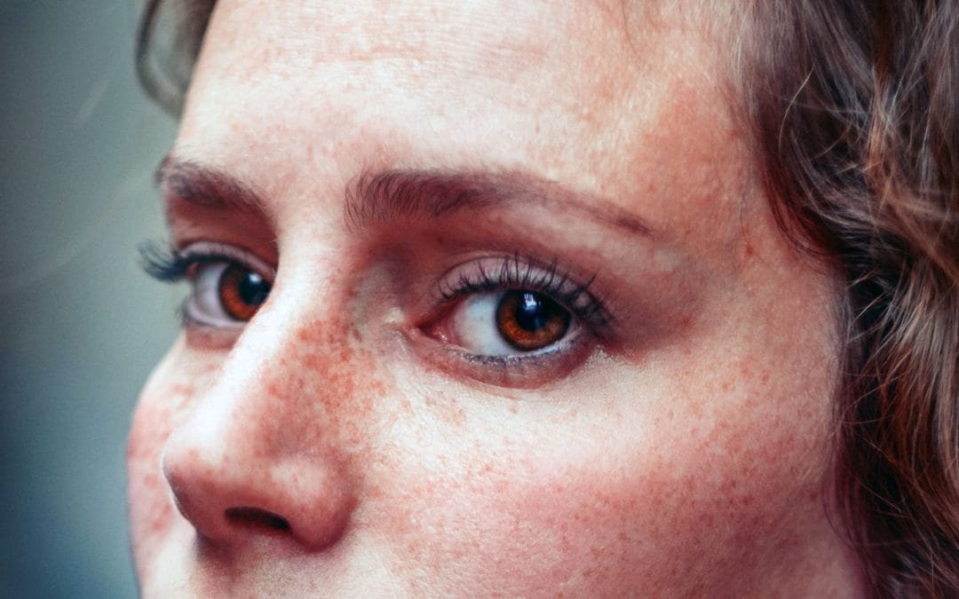 10 Things Your Face Can Reveal About Your Health