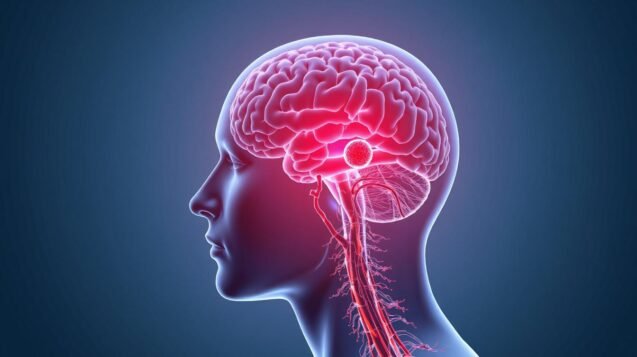 The People Most at Risk of a Blood Clot in the Brain